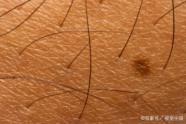 女人下面的毛发"茂盛",就会越"渴望"?真正影响欲望的有4点